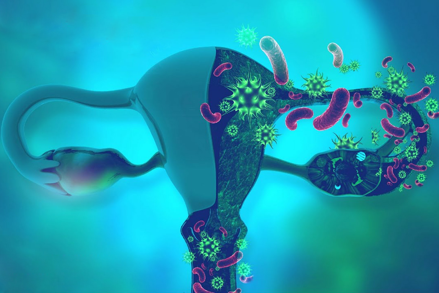 Microgenesis
