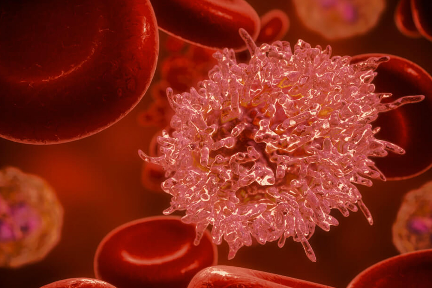OncoPrecision